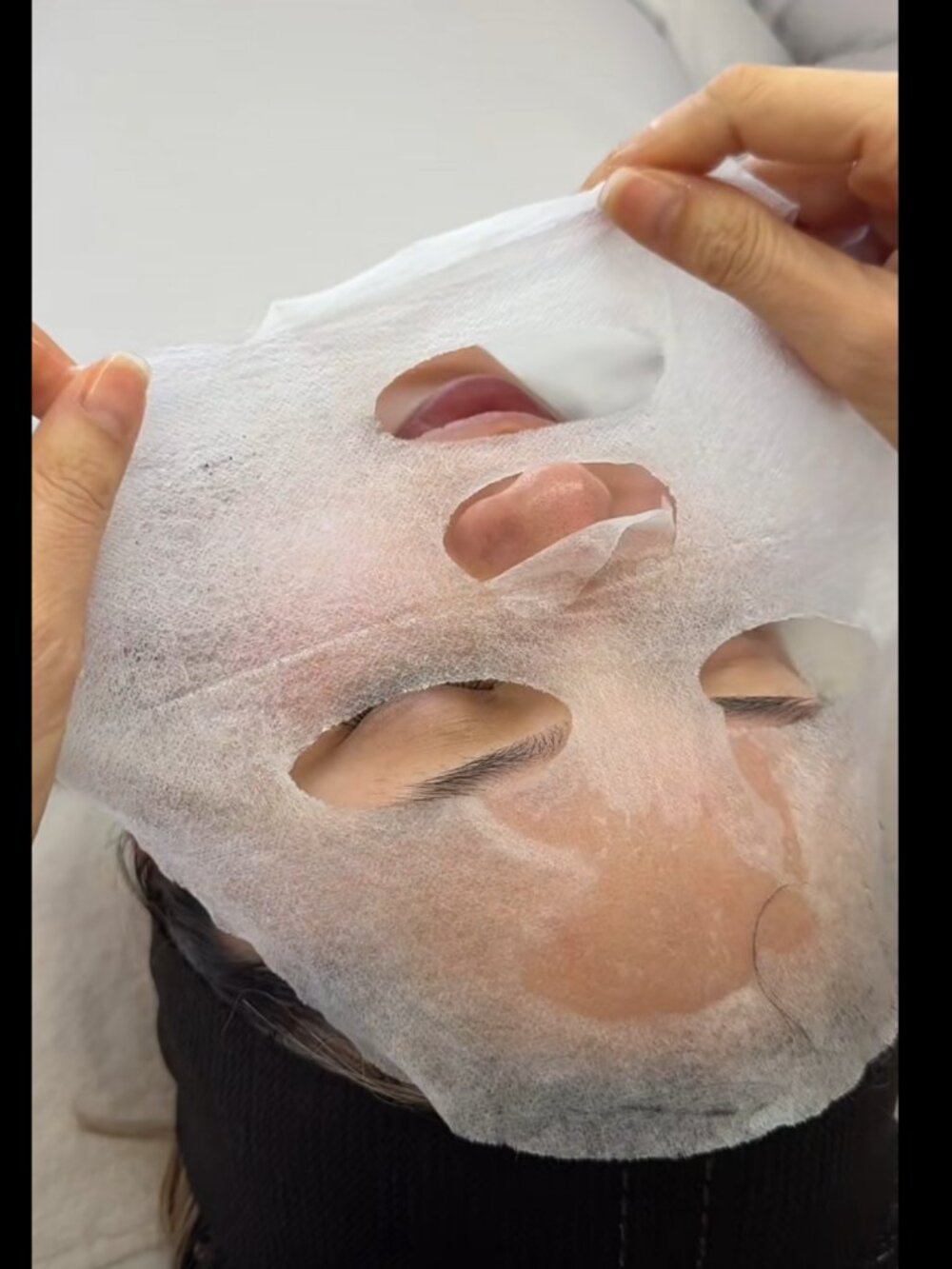 Salicylic Acid Masks